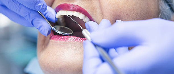 Best Emergency Treatment for Dental Infections or Abscesses in San Pablo, NM